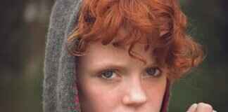 Bad Face Lift: Signs, Causes & How to Fix a Botched Surgery Bad Face Lift: Signs, Causes & How to Fix a Botched Surgery