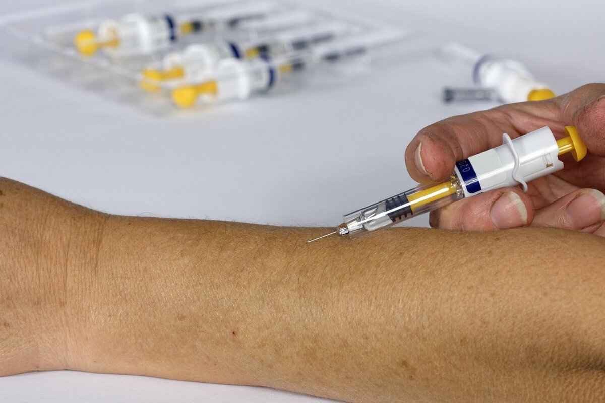How Long Does Filler Take to Settle? A Complete Timeline 2 The Injection Process Explained