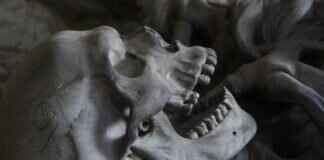 How Long Does It Take to Get Dentures? What You Need to Know How Long Does It Take to Get Dentures? What You Need to Know