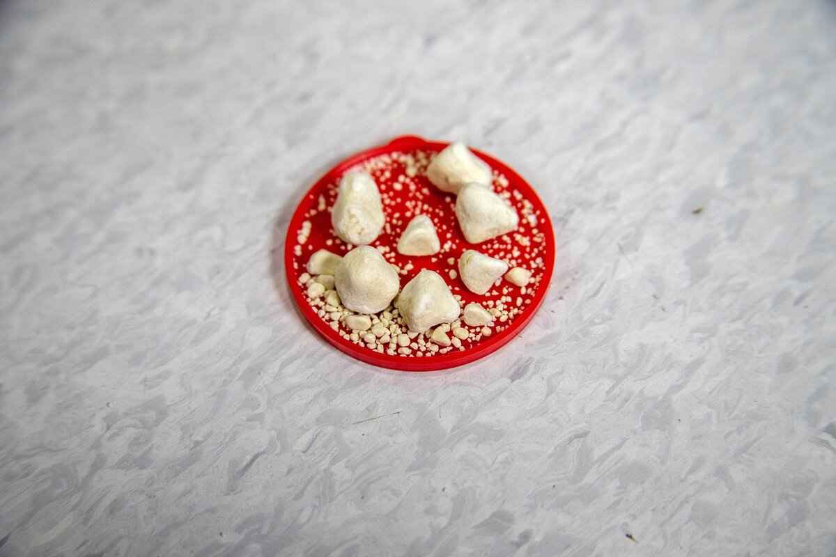 What Happens During Cataract Surgery?