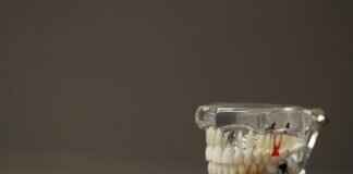 How Much Does It Cost to Reattach a Crown? Dental Costs & Options How Much Does It Cost to Reattach a Crown? Dental Costs & Options