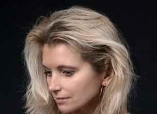 How Much Does It Cost to Repair a Chipped Tooth? What Are Your Options? How Much Does It Cost to Repair a Chipped Tooth? What Are Your Options?