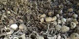 How to Reline Dentures Yourself: A DIY Solution How to Reline Dentures Yourself: A DIY Solution