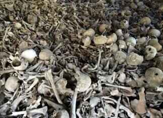 How to Reline Dentures Yourself: A DIY Solution How to Reline Dentures Yourself: A DIY Solution