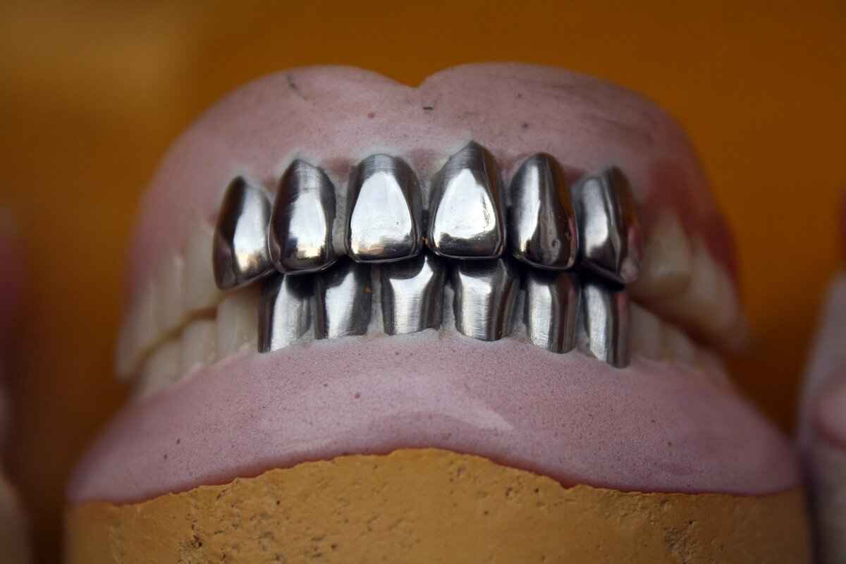 Signs Your Dentures Need Relining