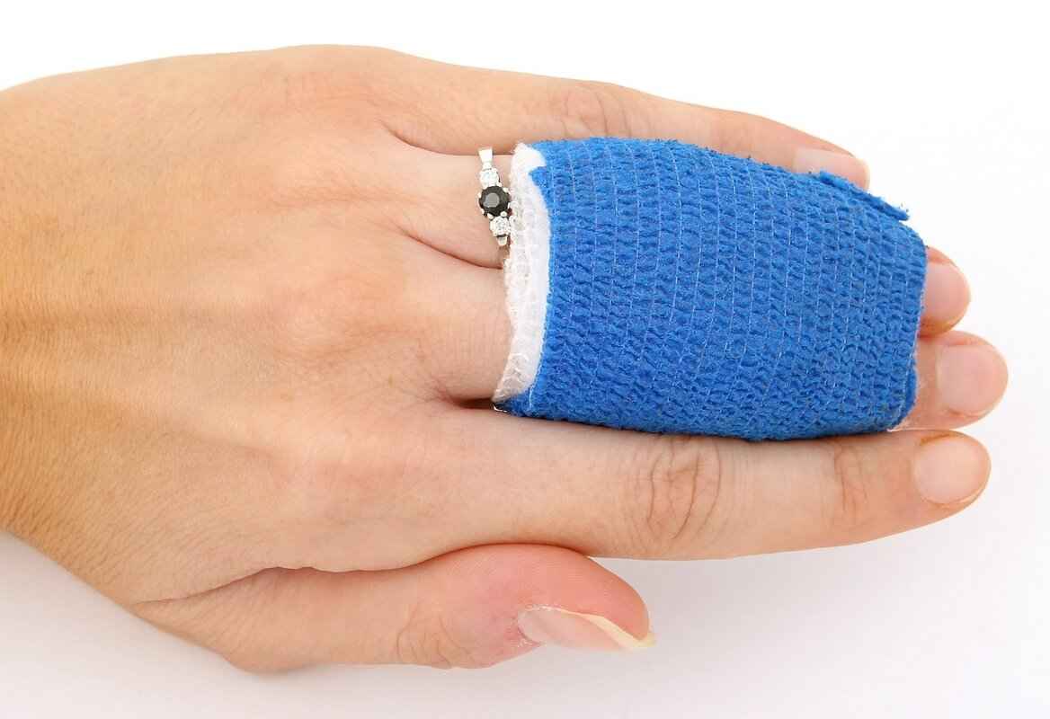 What to Do After a Workplace Injury? 4 Dealing with Insurance Companies
