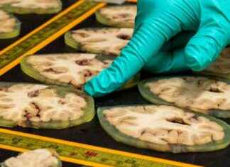 Alzheimer’s Project at Risk: Urgent Call for Support alzheimers-project-at-risk-urgent-call-for-support