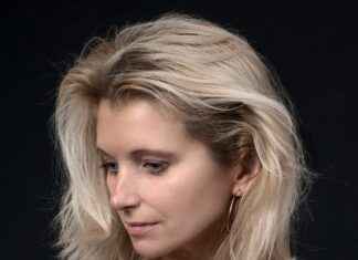 Best Hair Care Tips from Leading Hair Transplant Clinics  Best Hair Care Tips from Leading Hair Transplant Clinics # Best Hair Care Tips from Leading Hair Transplant Clinics