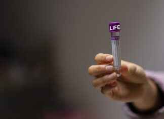 Can I Drink Water Before a Fasting Blood Test? What You Need to Know Can I Drink Water Before a Fasting Blood Test? What You Need to Know