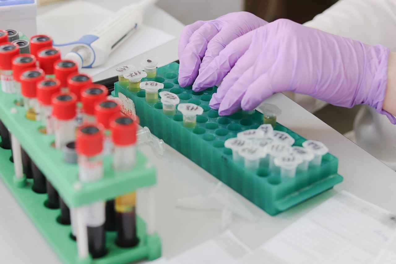 Can You Have Water Before a Fasting Blood Test? 3 Is It Okay to Drink Water Before a Blood Test?
