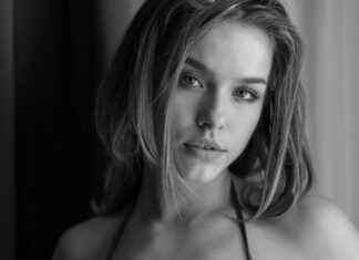 Comparing the Best Hair Transplant Clinics in Turkey – Which One to Choose? Comparing the Best Hair Transplant Clinics in Turkey – Which One to Choose?