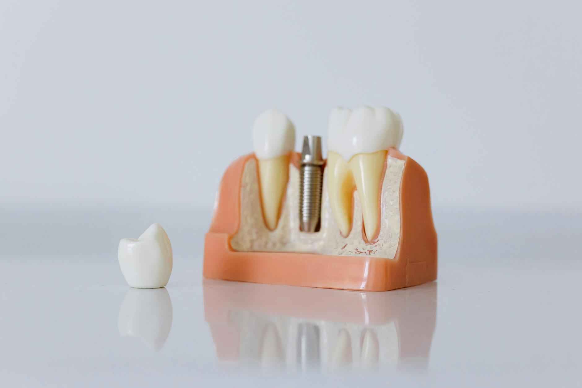 Maintenance and Care for Your Dentures