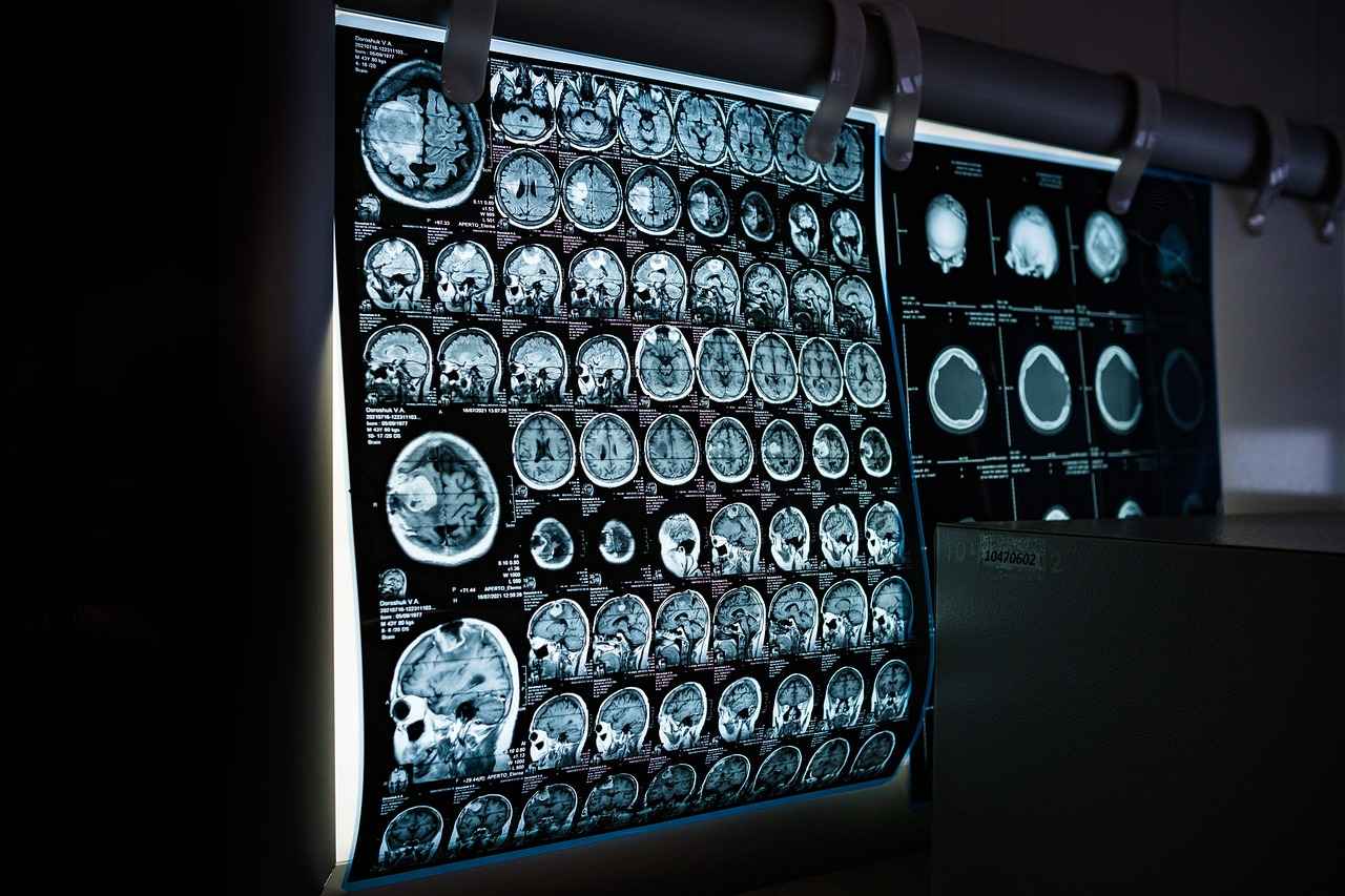 The Role of Lifestyle in Neurological Health