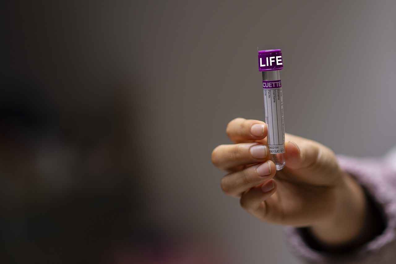 Should You Drink Water Before a Blood Test?