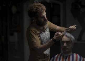 Hair Transplant in Los Angeles: Which Clinic Offers the Best Results? Hair Transplant in Los Angeles: Which Clinic Offers the Best Results?