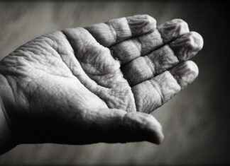 Harnessing the Anti-Aging Effects of Carnosine Harnessing the Anti-Aging Effects of Carnosine