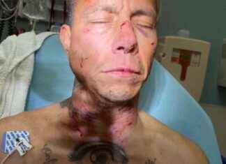 K-9 Attack Victim Receives $1.6 Million Settlement from San Jose k-9-attack-victim-receives-16-million-settlement-from-san-jose