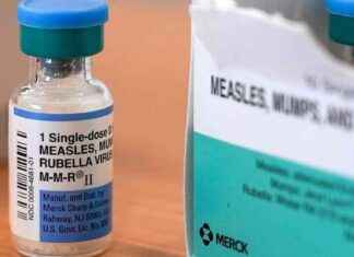 Measles Outbreak in Texas: 481 Cases, 59 New Infections in 3 Days measles-outbreak-in-texas-481-cases-59-new-nfections-in-3-days