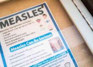 Michigan Measles Outbreak 2021: What You Need to Know michigan-measles-outbreak-2021-what-you-need-to-know