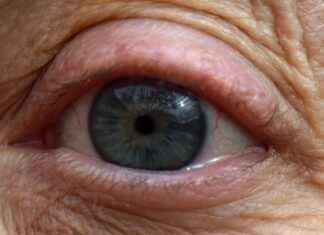 Supporting Eye Health with Astaxanthin Capsules Supporting Eye Health with Astaxanthin Capsules