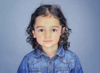 What to Expect After a Hair Transplant – A Guide from Top Clinics What to Expect After a Hair Transplant – A Guide from Top Clinics