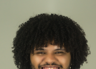 Braces Before After: Transform Your Smile With Stunning Results